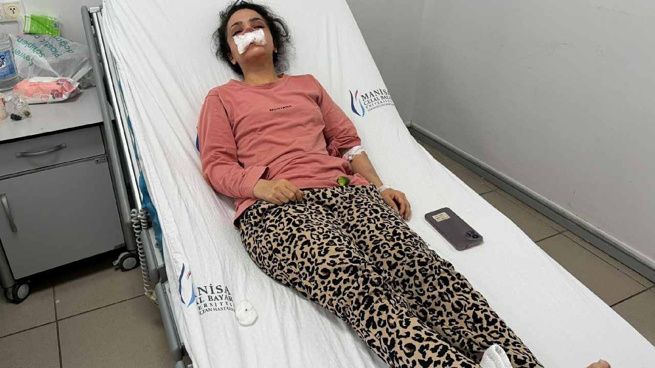 Burnu eşi tarafından koparılan İmran dehşeti anlattı: Acıyla balkondan atlamayı bile düşündüm Img